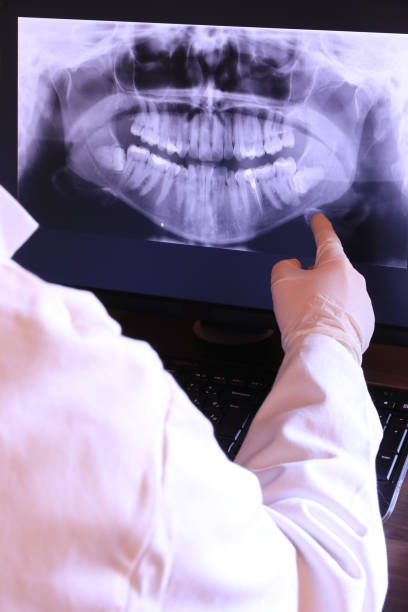 Best Emergency Wisdom Teeth Removal in La Crosse, KS